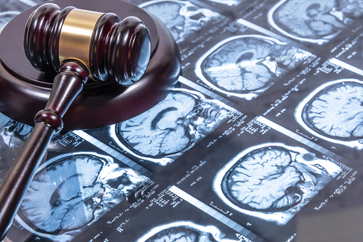 Understanding Traumatic Brain Injuries