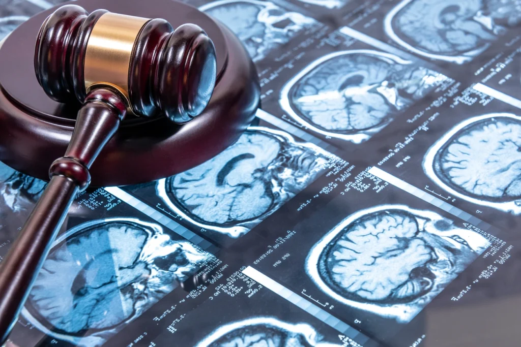 experienced Brain injury attorney in Atlanta
